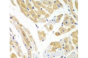 Immunohistochemistry of paraffin-embedded Mouse heart using PCBP2 Polyclonal Antibody at dilution of 1:100 (40x lens). (PCBP2 antibody)
