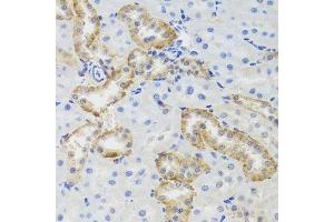 Immunohistochemistry of paraffin-embedded rat kidney using MTERFD3 antibody. (MTERFD3 antibody  (AA 1-250))