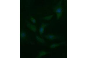 Image no. 3 for anti-CD33 (CD33) antibody (ABIN1497269) (CD33 antibody)