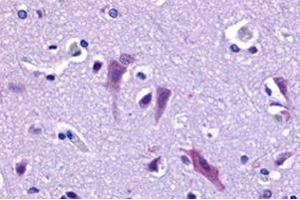Immunohistochemical staining of human brain, neurons and glia with QRFPR polyclonal antibody . (QRFPR antibody  (Extracellular Domain))
