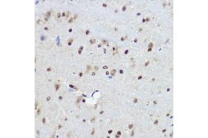 Immunohistochemistry of paraffin-embedded Mouse brain using FANCC antibody (ABIN3022593, ABIN3022594, ABIN3022595 and ABIN6218931) at dilution of 1:100 (40x lens). (FANCC antibody  (AA 319-558))