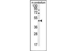 Western blot analysis of FUS Antibody (C-term) in mouse cerebellum tissue lysates (15ug/lane). (FUS antibody  (C-Term))