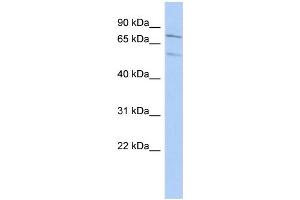 WB Suggested Anti-ZNF395 Antibody Titration: 0.