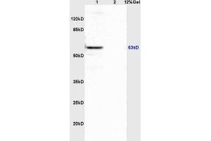 Lane 1: mouse spleen lysates Lane 2: mouse brain lysates probed with Anti APBA3/Mint3/X11 gamma Polyclonal Antibody, Unconjugated (ABIN1385696) at 1:200 in 4 °C. (APBA3 antibody  (AA 241-340))