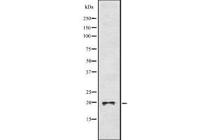 Western blot analysis of DUSP3 using MCF7 whole cell lysates (Dual Specificity Phosphatase 3 (DUSP3) (N-Term) antibody)