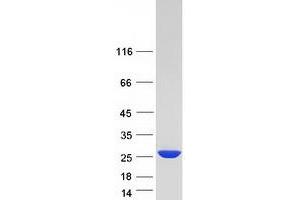 Western Blotting (WB) image for Nudix (Nucleoside Diphosphate Linked Moiety X)-Type Motif 16 (NUDT16) protein (Myc-DYKDDDDK Tag) (ABIN2727747)