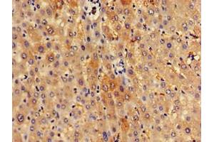 Immunohistochemistry of paraffin-embedded human liver tissue using ABIN7170645 at dilution of 1:100 (SPRED1 antibody  (AA 123-311))