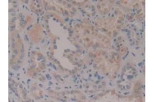 DAB staining on IHC-P; Samples: Human Kidney Tissue (CENPF antibody  (AA 436-637))