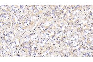 Detection of SIRT3 in Human Stomach Tissue using Monoclonal Antibody to Sirtuin 3 (SIRT3) (SIRT3 antibody  (AA 126-399))