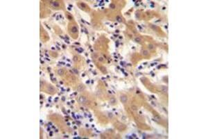 Formalin fixed and paraffin embedded human liver tissue stained with F11 Antibody (Center) followed by peroxidase conjugation of the secondary antibody and DAB staining.