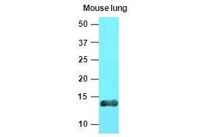 Western Blotting (WB) image for anti-Vesicle-Associated Membrane Protein 3 (VAMP3) (AA 1-77), (N-Term) antibody (ABIN336092) (VAMP3 antibody  (N-Term))