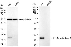 Western blotting analysis using Peroxiredoxin 5 antibody (ABIN7799780).