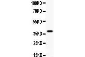 Anti- FHIT Picoband antibody, Western blotting All lanes: Anti FHIT  at 0. (FHIT antibody  (AA 1-147))