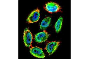 Confocal immunofluorescent analysis of Phospho-P53-S9 Antibody (ABIN1881624 and ABIN2850450) with  cell followed by Alexa Fluor 488-conjugated goat anti-rabbit lgG (green). (p53 antibody  (pSer9))