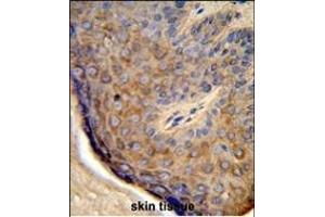 Formalin-fixed and paraffin-embedded human skin tissue reacted with TCHP Antibody (Center), which was peroxidase-conjugated to the secondary antibody, followed by DAB staining. (TCHP antibody  (AA 291-320))