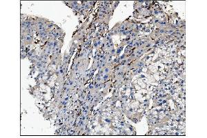 IHC analysis of CD16 using anti-CD16 antibody (ABIN5693196).