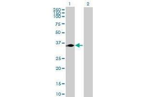 Lane 1: KCTD7 transfected lysate ( 33.