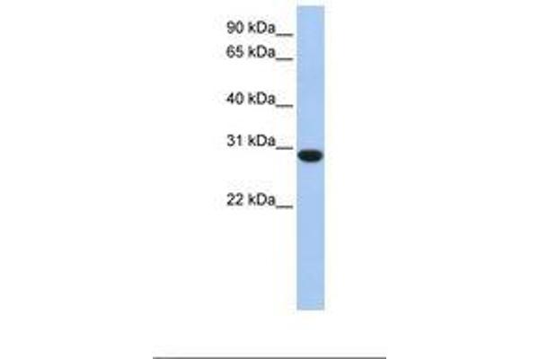 ASB12 antibody  (C-Term)