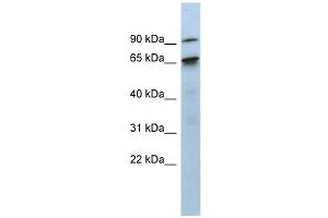 KIAA0427 antibody used at 1 ug/ml to detect target protein. (CTIF/KIAA0427 antibody  (N-Term))