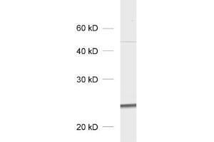 dilution: 1 : 1000, sample: total cell lysate of GFP transfected fibroblasts (GFP antibody)