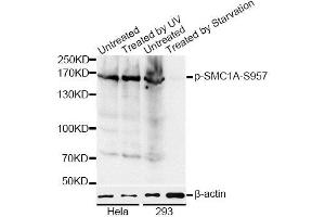 Western blot analysis of extracts of HeLa and 293 cells, using Phospho-SMC1A-S957 antibody (ABIN5969934) at 1/1000 dilution. (SMC1A antibody  (pSer957))