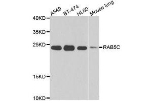 Western blot analysis of extracts of various cell lines, using RAB5C antibody. (Rab5c antibody  (AA 1-216))