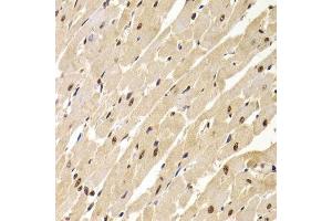 Immunohistochemistry (Paraffin-embedded Sections) (IHC (p)) image for anti-Small Nuclear Ribonucleoprotein Polypeptide A (SNRPA) (AA 1-282) antibody (ABIN6148210)