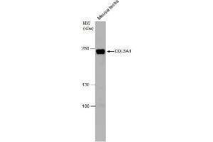 WB Image COL3A1 antibody [C2C3], C-term detects COL3A1 protein by western blot analysis. (COL3A1 antibody  (C-Term))