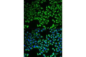 Immunofluorescence analysis of MCF-7 cell using CS antibody.