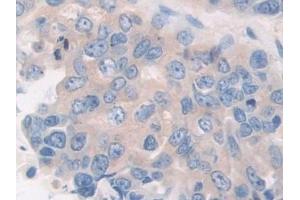 Immunohistochemistry (IHC) image for anti-Calcineurin (CAN) (AA 7-301) antibody (ABIN7433471)