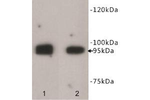 Western Blotting (WB) image for anti-Leucine-Rich Repeat Containing G Protein-Coupled Receptor 5 (LGR5) antibody (ABIN1854936) (LGR5 antibody)