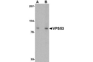 Image no. 1 for anti-Vacuolar Protein Sorting 53 Homolog (VPS53) (C-Term) antibody (ABIN1492163) (VPS53 antibody  (C-Term))