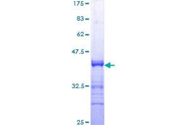 STAT1 Protein (AA 613-712) (GST tag)