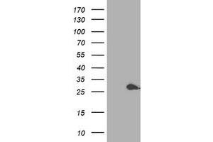 HEK293T cells were transfected with the pCMV6-ENTRY control (Left lane) or pCMV6-ENTRY PSMB4 (Right lane) cDNA for 48 hrs and lysed. (PSMB4 antibody)