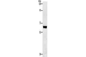 Gel: 8 % SDS-PAGE, Lysate: 40 μg, Lane: Jurkat cells, Primary antibody: ABIN7192880(TRAF7 Antibody) at dilution 1/300, Secondary antibody: Goat anti rabbit IgG at 1/8000 dilution, Exposure time: 2 minutes (TRAF7 antibody)