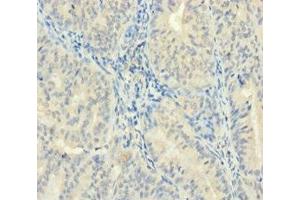 ZMAT5 antibody  (AA 1-170)