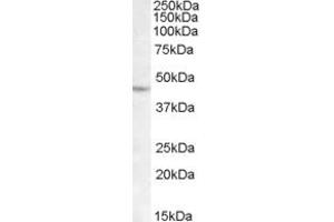 ABIN263221 (1µg/ml) staining of DAUDI lysate (35µg protein in RIPA buffer). (LHX2 antibody  (C-Term))