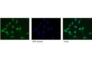 CD107a / LAMP1 Antibody Cat. (LAMP1 antibody)