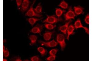 ABIN6273990 staining HepG2 by IF/ICC. (ALAS1 antibody  (Internal Region))