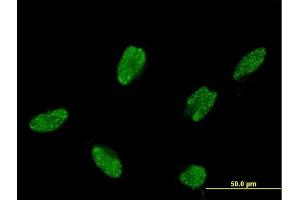 Immunofluorescence of monoclonal antibody to ASCL1 on HeLa cell. (ASCL1 antibody  (AA 137-236))