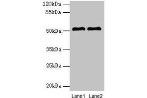 Western blot All lanes: SLC30A6 antibody at 6 μg/mL Lane 1: A549 whole cell lysate Lane 2: U251 whole cell lysate Secondary Goat polyclonal to rabbit IgG at 1/10000 dilution Predicted band size: 52, 56, 48, 49 kDa Observed band size: 52 kDa (SLC3A6 (AA 246-461) antibody)