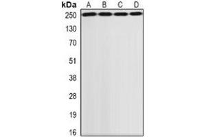 Western blot analysis of GCN2 expression in SKOV3 (A), HepG2 (B), MCF7 (C), rat lung (D) whole cell lysates. (GCN2 antibody)