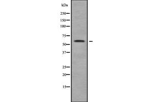 Western blot analysis of MAGE2 using COLO205 whole cell lysates (MAGEE2 antibody  (Internal Region))