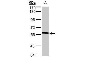 WB Image Sample(30 ug whole cell lysate) A:A431, 7. (XPNPEP3 antibody)