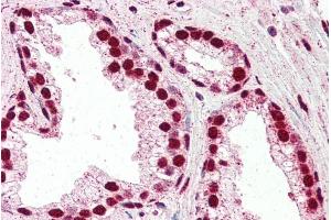 Immunohistochemistry (IHC) image for anti-Interferon Regulatory Factor 6 (IRF6) (C-Term) antibody (ABIN184730)