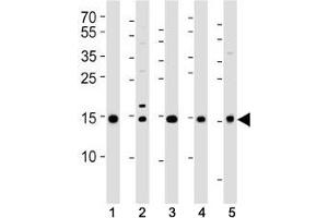 Western blot analysis of lysate from (1) 293T, (2) HeLa, (3) HL-60, (4) Jurkat cell lines and (5) rat liver tissue using SUMO2/3 antibody at 1:1000. (SUMO2/3 antibody  (AA 49-81))
