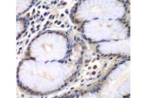 Immunohistochemistry of paraffin-embedded Human colon using PSMB2 Polyclonal Antibody at dilution of 1:100 (40x lens). (PSMB2 antibody)