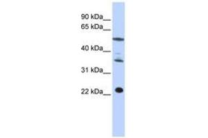 Image no. 1 for anti-Centromere Protein M (CENPM) (C-Term) antibody (ABIN6740964) (CENPM antibody  (C-Term))
