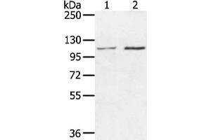Gel: 6 % SDS-PAGE, Lysate: 40 μg, Lane 1-2: Hepg2 and hela cell, Primary antibody: ABIN7130215(MED16 Antibody) at dilution 1/400 dilution, Secondary antibody: Goat anti rabbit IgG at 1/8000 dilution, Exposure time: 20 seconds