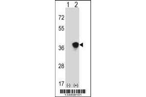 Western blot analysis of Map2k3 using rabbit polyclonal Mouse Map2k3 Antibody using 293 cell lysates (2 ug/lane) either nontransfected (Lane 1) or transiently transfected (Lane 2) with the Map2k3 gene. (MAP2K3 antibody  (AA 132-160))